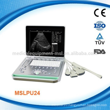 MSLPU24K newest medical equipment portable/ laptop ultrasound scanner price